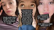Aimee Lou Wood's Instagram Stories | Image Source: Instagram/ @aimeelouwood